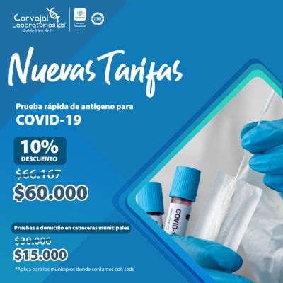 Prueba rápida de antígeno covid-19