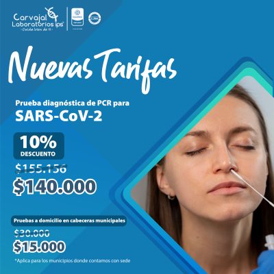 Prueba diagnóstica de pcr para sars-cov-2